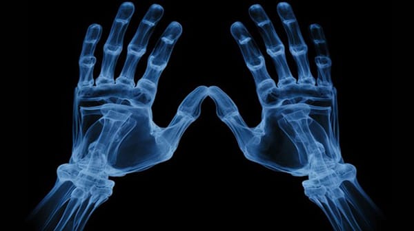 X-ray Skeleton Hands X-ray Skeleton Hands